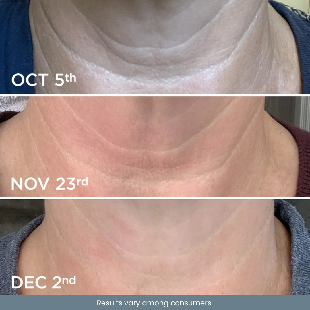 Tighten & Lift Neck Cream